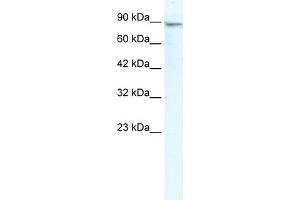 WB Suggested Anti-MCM4 Antibody Titration:  2. (MCM4 anticorps  (N-Term))