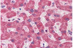 Human Liver: Formalin-Fixed, Paraffin-Embedded (FFPE)