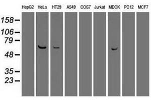 Image no. 7 for anti-Polo-Like Kinase 1 (PLK1) antibody (ABIN1500283)