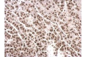IHC-P Image COBRA1 antibody detects COBRA1 protein at nucleus on HBL435 xenograft by immunohistochemical analysis.