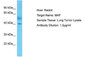 Host: Rabbit Target Name: MAF Sample Type: Lung Tumor lysates Antibody Dilution: 1. (MAF anticorps  (C-Term))