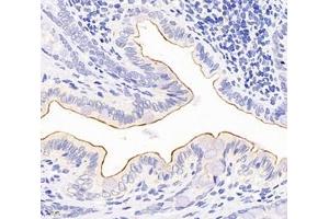 Immunohistochemistry analysis of paraffin-embedded rat colon using,TSPAN1 (ABIN7075867) at dilution of 1: 4000 (TSPAN1 anticorps)