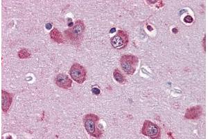 anti-Period Circadian Protein 2 (PER2) (AA 1-101) antibody