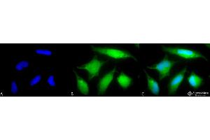 Immunocytochemistry/Immunofluorescence analysis using Rabbit Anti-Rab5 Polyclonal Antibody .