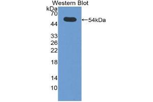 Western blot analysis of the recombinant protein. (SIAE anticorps  (AA 22-244))