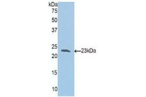 Western blot analysis of recombinant Human Slit1. (SLIT1 anticorps  (AA 647-835))