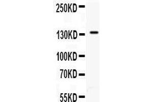 Anti- CD62P antibody, Western blotting All lanes: Anti CD62P  at 0.