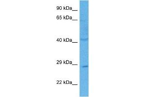 Host:  Rabbit  Target Name:  C21ORF58  Sample Tissue:  Human PANC1 Whole Cell lysates  Antibody Dilution:  1ug/ml (C21orf58 anticorps  (N-Term))