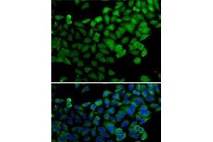 Immunofluorescence analysis of A-549 cells using SYNCRIP Polyclonal Antibody (SYNCRIP anticorps)