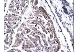 Image no. 2 for anti-TAF15 RNA Polymerase II, TATA Box Binding Protein (TBP)-Associated Factor, 68kDa (TAF15) (AA 42-91) antibody (ABIN6735812)