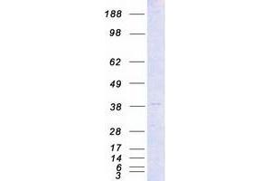 Validation with Western Blot