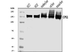 Western blot analysis of CPS1 using anti-CPS1 antibody (ABIN7599871). (CPS1 anticorps  (AA 124-379))