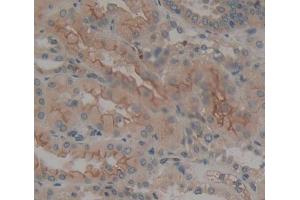 Used in DAB staining on fromalin fixed paraffin- embedded kidney tissue