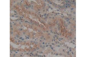 Used in DAB staining on fromalin fixed paraffin- embedded kidney tissue (PTPRE anticorps  (AA 346-500))
