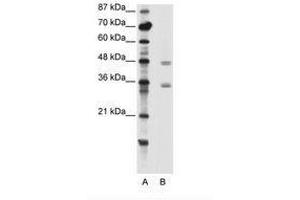 Image no. 1 for anti-Chromobox Homolog 8 (CBX8) (C-Term) antibody (ABIN202404) (CBX8 anticorps  (C-Term))