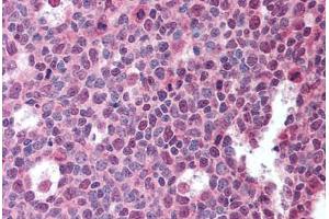 Human Tonsil (formalin-fixed, paraffin-embedded) stained with TNFSF13B antibody ABIN239856 at 10 ug/ml followed by biotinylated anti-mouse IgG secondary antibody ABIN481714, alkaline phosphatase-streptavidin and chromogen. (BAFF anticorps)