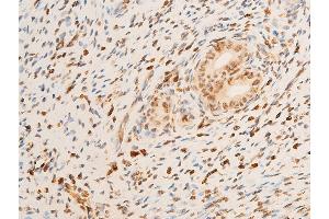 ABIN6267286 at 1/100 staining rat uterine tissue sections by IHC-P.