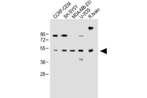 All lanes : Anti-EDIL3 Antibody (Center) at 1:1000 dilution Lane 1: CCRF-CEM whole cell lysate Lane 2: SH-SY5Y whole cell lysate Lane 3: MDA-MB-231 whole cell lysate Lane 4: U-2OS whole cell lysate Lane 5: Rat brain whole lysate Lysates/proteins at 20 μg per lane. (EDIL3 anticorps  (AA 337-365))