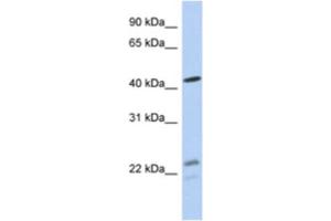Western Blotting (WB) image for anti-Branched Chain Keto Acid Dehydrogenase E1, alpha Polypeptide (BCKDHA) antibody (ABIN2463953) (BCKDHA anticorps)