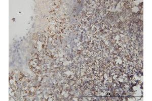 Immunoperoxidase of monoclonal antibody to TES on formalin-fixed paraffin-embedded human tonsil tissue.