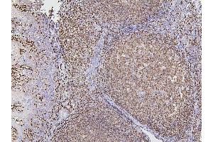 IHC analysis of PAX5 using anti-PAX5 antibody (ABIN7600655).