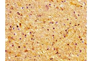 Immunohistochemistry of paraffin-embedded human brain tissue using ABIN7147463 at dilution of 1:100
