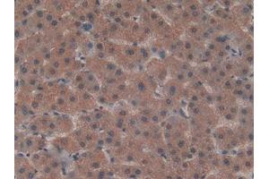 DAB staining on IHC-P; Samples: Human Liver Tissue (LRP5L anticorps  (AA 7-238))