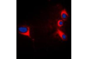 Immunofluorescent analysis of cTnI staining in HepG2 cells.