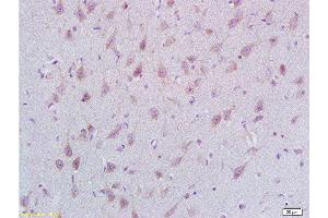 Formalin-fixed and paraffin embedded rat brain labeled with Rabbit Anti STMN2/SCG10 Polyclonal Antibody, Unconjugated  at 1:200 followed by conjugation to the secondary antibody and DAB staining
