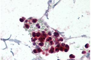 Human Colon, Neutrophils (formalin-fixed, paraffin-embedded) stained with NCF1 antibody ABIN337093 at 5 ug/ml followed by biotinylated anti-goat IgG secondary antibody ABIN481715, alkaline phosphatase-streptavidin and chromogen. (NCF1 anticorps  (AA 378-390))
