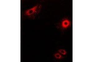 Immunofluorescent analysis of Secretogranin-2 staining in MCF7 cells. (SCG2 anticorps)