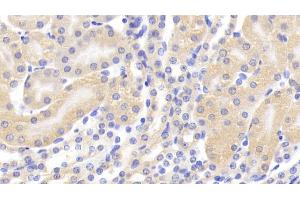 Detection of CASP1 in Mouse Kidney Tissue using Polyclonal Antibody to Caspase 1 (CASP1)