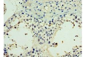 Immunohistochemistry of paraffin-embedded human testis tissue using ABIN7161904 at dilution of 1:100 (TR4 anticorps  (AA 240-380))