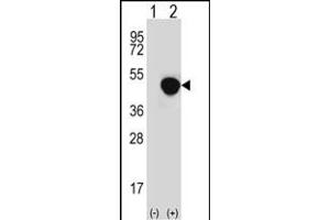 Western blot analysis of LRG1 (arrow) using rabbit polyclonal LRG1 Antibody (N-term) (ABIN652229 and ABIN2840955). (LRG1 anticorps  (N-Term))