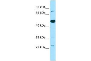 WB Suggested Anti-TBXAS1 Antibody Titration: 1. (TBXAS1 anticorps  (C-Term))