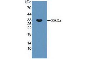Figure. (RPS6KB1 anticorps  (AA 91-352))