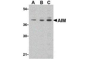 Western Blotting (WB) image for anti-CD5 Molecule-Like (CD5L) (C-Term) antibody (ABIN2472165) (CD5L anticorps  (C-Term))