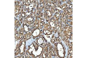 IHC analysis of SDF2L1 using anti-SDF2L1 antibody (ABIN7601111). (SDF2L1 anticorps  (AA 29-221))