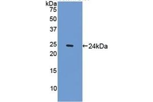 Detection of Recombinant SPRY1, Mouse using Polyclonal Antibody to Sprouty Homolog 1 (SPRY1)