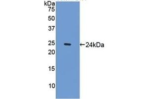 Detection of Recombinant SPRY1, Mouse using Polyclonal Antibody to Sprouty Homolog 1 (SPRY1) (SPRY1 anticorps  (AA 112-303))