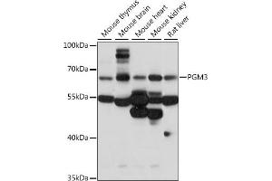 anti-Phosphoglucomutase 3 (PGM3) (AA 1-300) antibody
