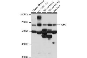 Western blot analysis of extracts of various cell lines, using PGM3 antibody (ABIN7269313) at 1:1000 dilution. (Phosphoglucomutase 3 anticorps  (AA 1-300))