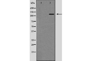 Western blot analysis of JAK1 expression in EGF treated MCF7 whole cell lysates,The lane on the left is treated with the antigen-specific peptide. (JAK1 anticorps)