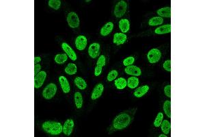 Immunofluorescence Analysis of PFA fixed HeLa cells labeling Cyclin B1 Mouse Monoclonal Antibody (V92.