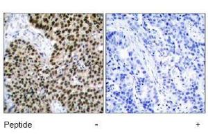 Image no. 2 for anti-Heat Shock Factor Protein 1 (HSF1) (Ser303) antibody (ABIN197514) (HSF1 anticorps  (Ser303))