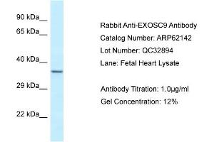 Western Blotting (WB) image for anti-Exosome Component 9 (EXOSC9) (N-Term) antibody (ABIN2789034)