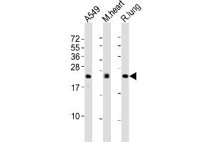 All lanes : Anti-FGF2 Antibody at 1:2000 dilution Lane 1: A549 whole cell lysates Lane 2: mouse heart lysates Lane 3: rat lung lysates Lysates/proteins at 20 μg per lane. (FGF2 anticorps)