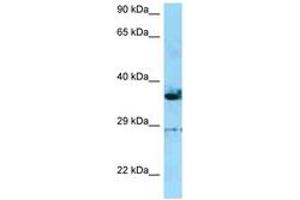 Image no. 1 for anti-Inverted Formin, FH2 and WH2 Domain Containing (INF2) (C-Term) antibody (ABIN6748410) (INF2 anticorps  (C-Term))
