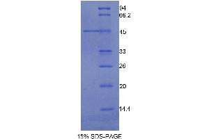 SDS-PAGE analysis of Human Integrin alpha M (ITGAM) Protein.