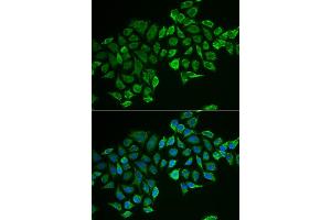 Immunofluorescence analysis of MCF-7 cells using RHOD antibody (ABIN6131344, ABIN6146938, ABIN6146939 and ABIN6222119).